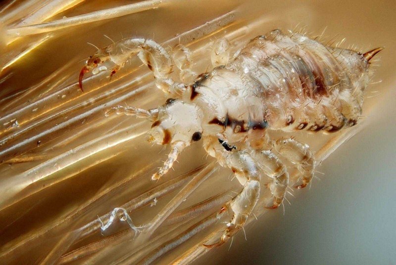 Головная вошь (Pediculus humanus capitis)