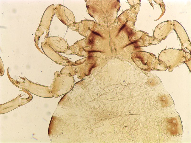 Pediculus humanus humanus яйцо