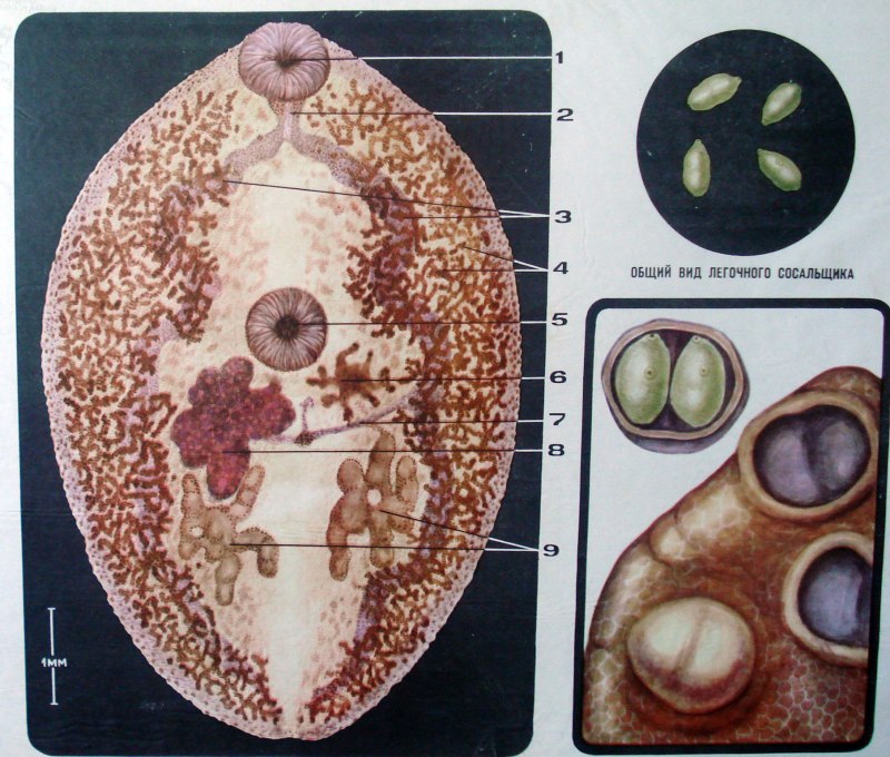 . Paragonimus westermani (легочный сосальщик). Яйцо