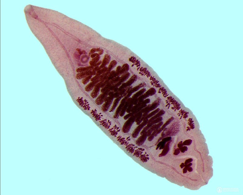 Opisthorchis felineus Кошачья двуустка