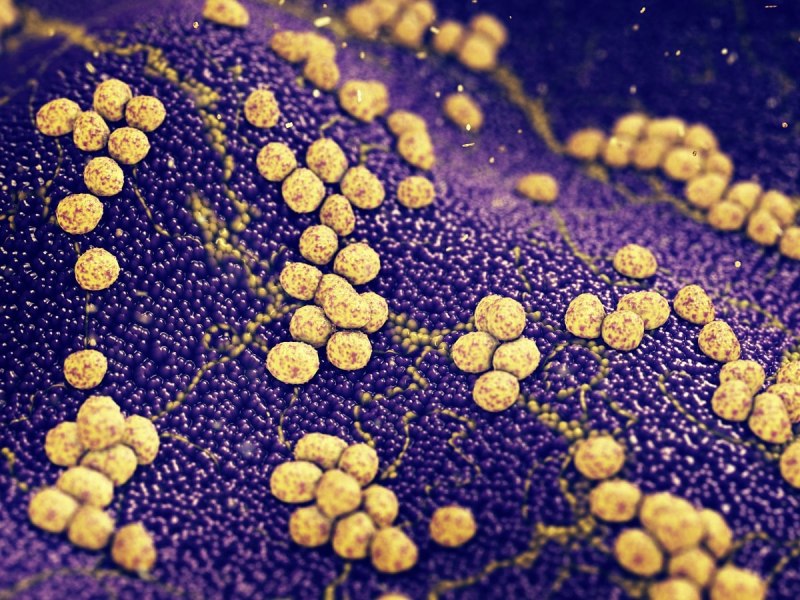 S. aureus золотистый стафилококк