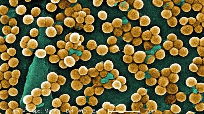 Золотистый стафилококк MRSA