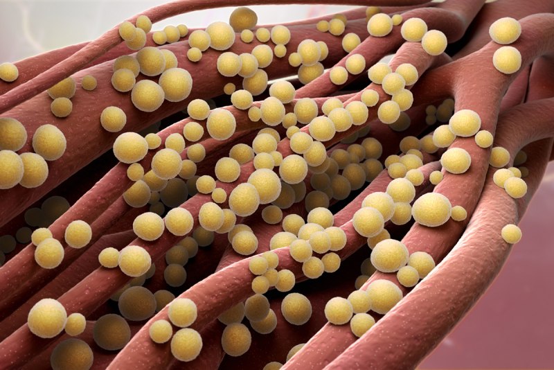 Золотистый стафилококк MRSA