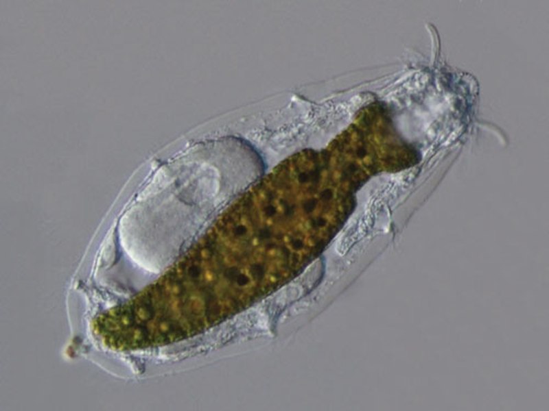 Chaetonotus Maximus