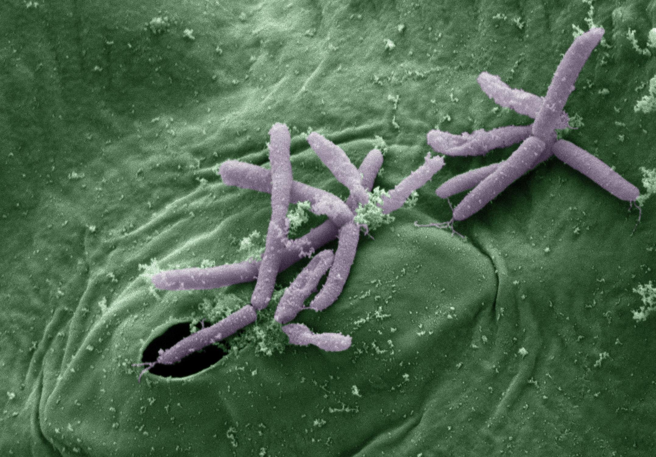 Вирус слизь. Бактерии Pseudomonas syringae. Сиреневый псевдомонас. Pseudomonas syringae под микроскопом. Pseudomonas syringae заморозка воды процесс.