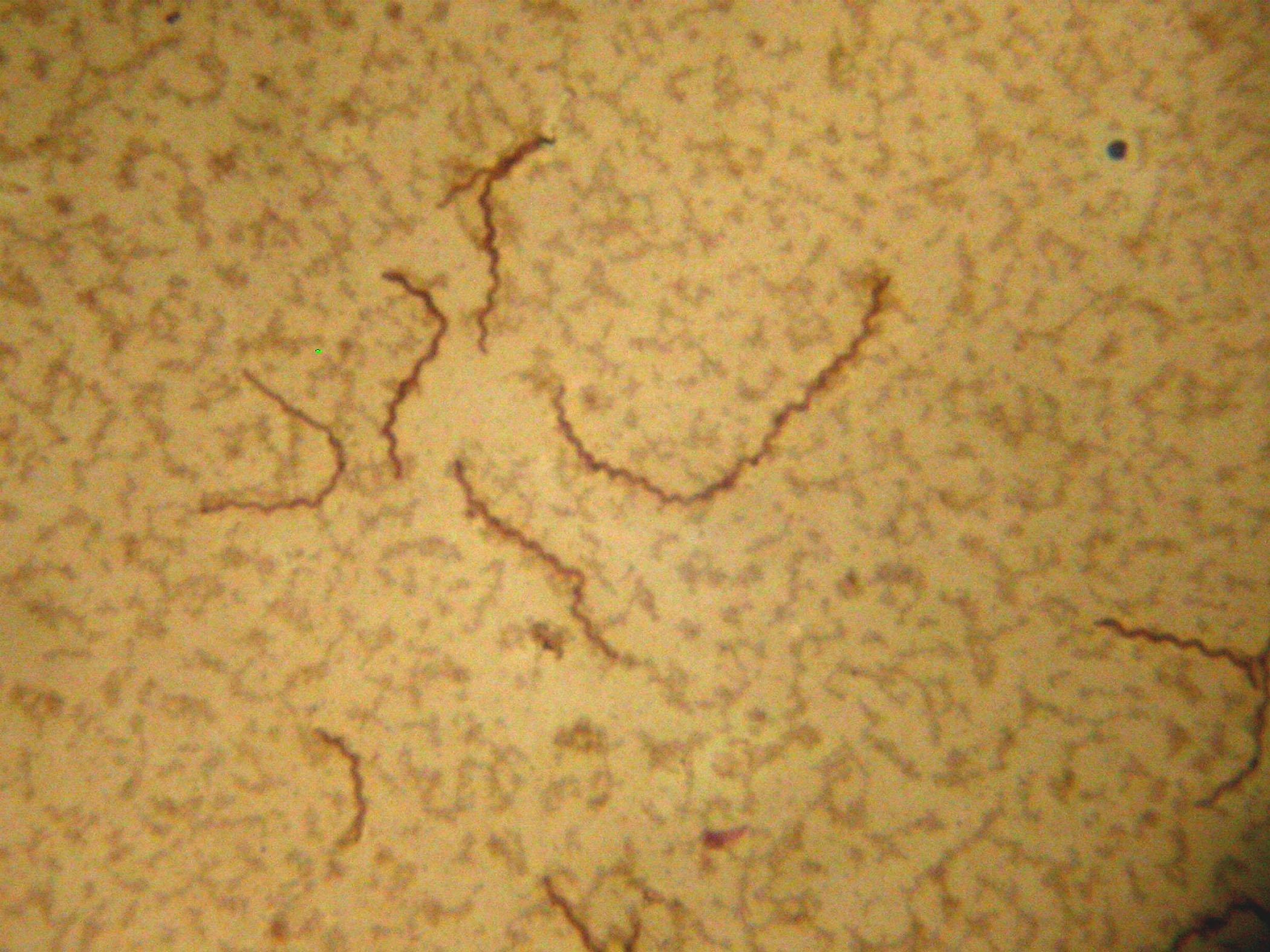 Заболевания вызываемые трепонемой. Бледная трепонема (Treponema pallidum). Бледная спирохета микробиология. Бледная трепонема Романовский Гимзе. Бледная спирохета под микроскопом.