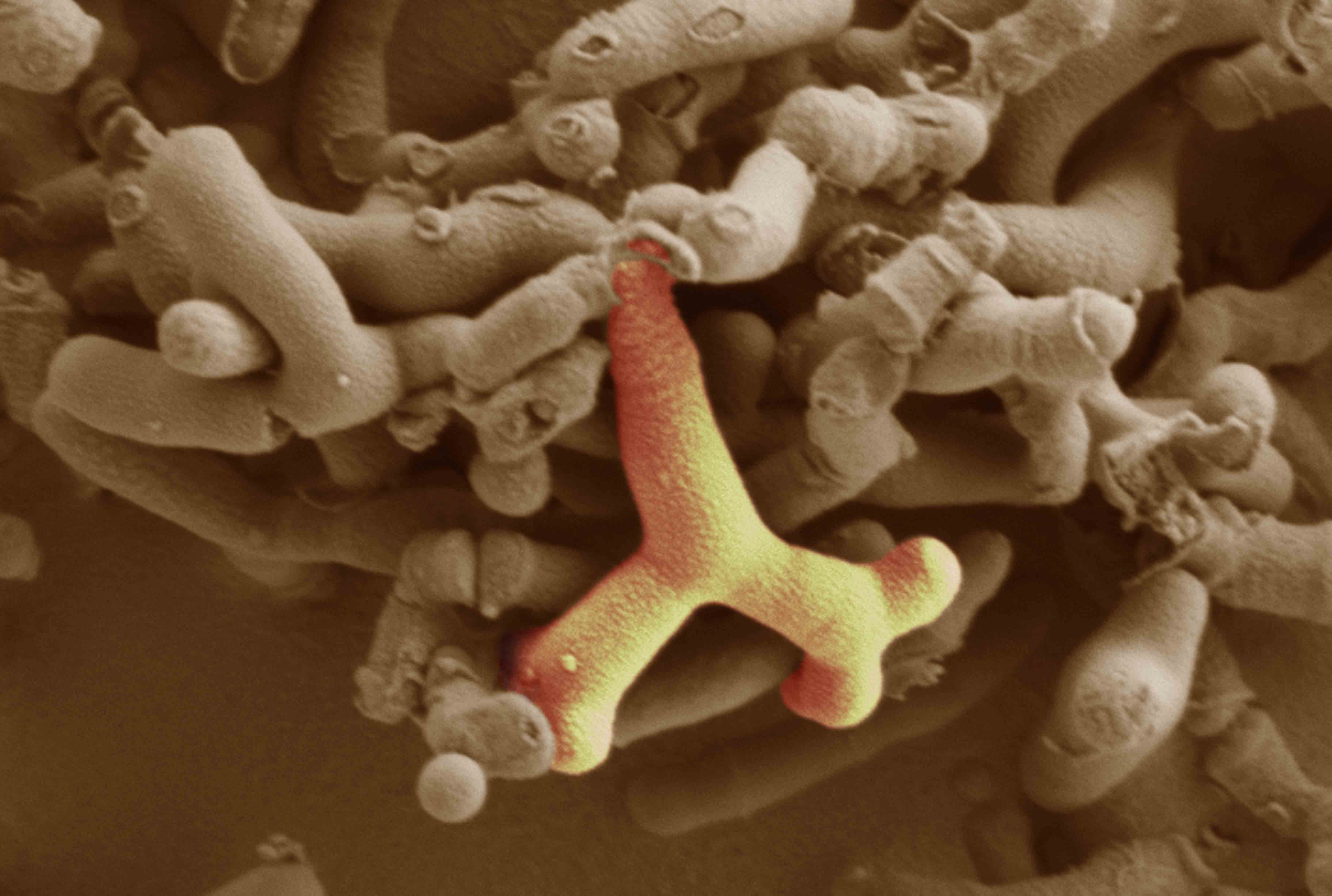 Микробио. Бифидобактерии. Пробиотики под микроскопом. Бифидобактерии с 0. Bifidobacterium bifidum.