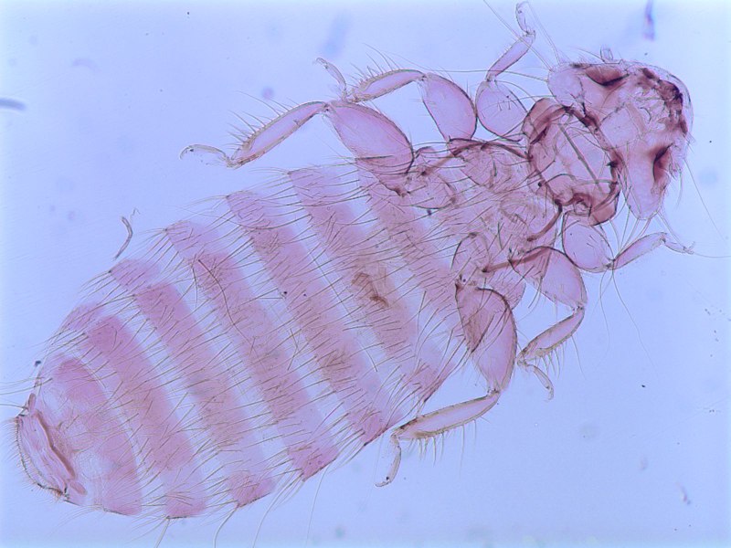 Menopon gallinae