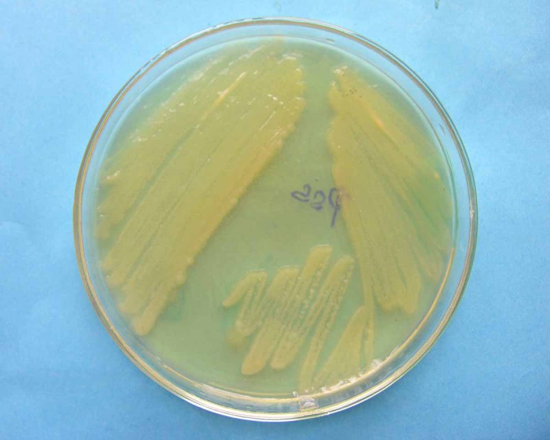 Колония бактерий Pseudomonas Fluorescens