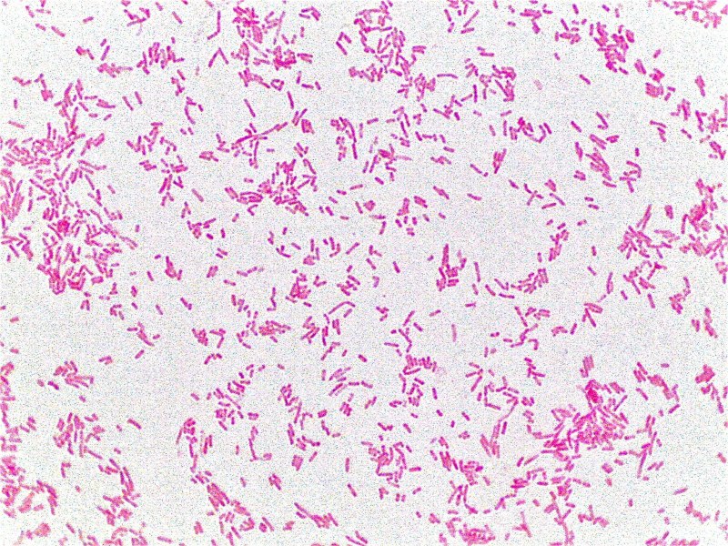 Escherichia coli по Граму