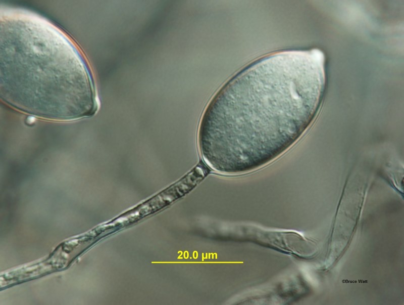 Phytophthora infestans под микроскопом
