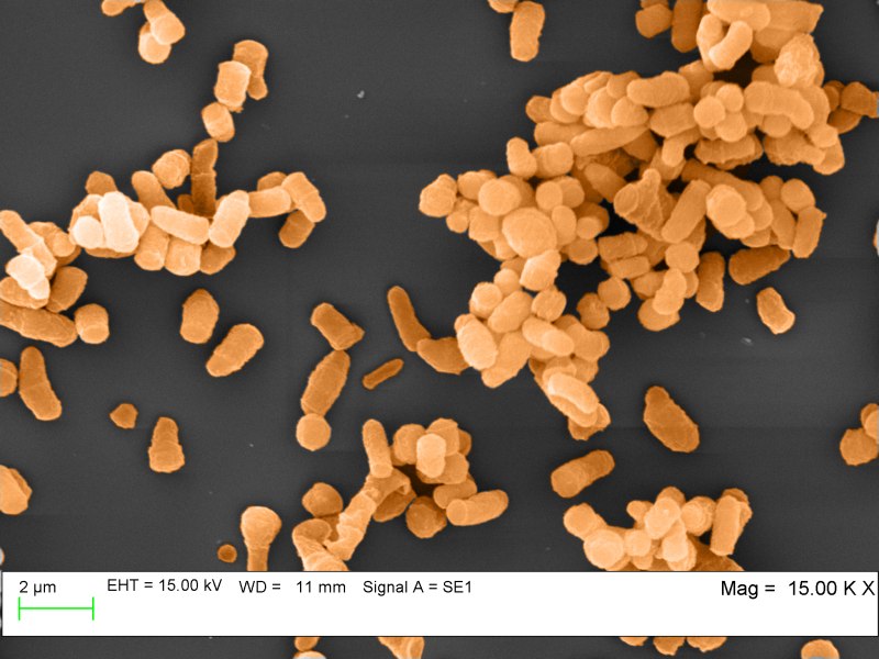 Rhodococcus luteus