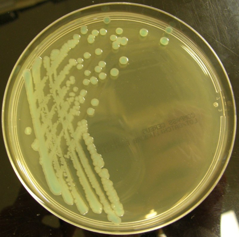 Bacillus Cereus Ожешко