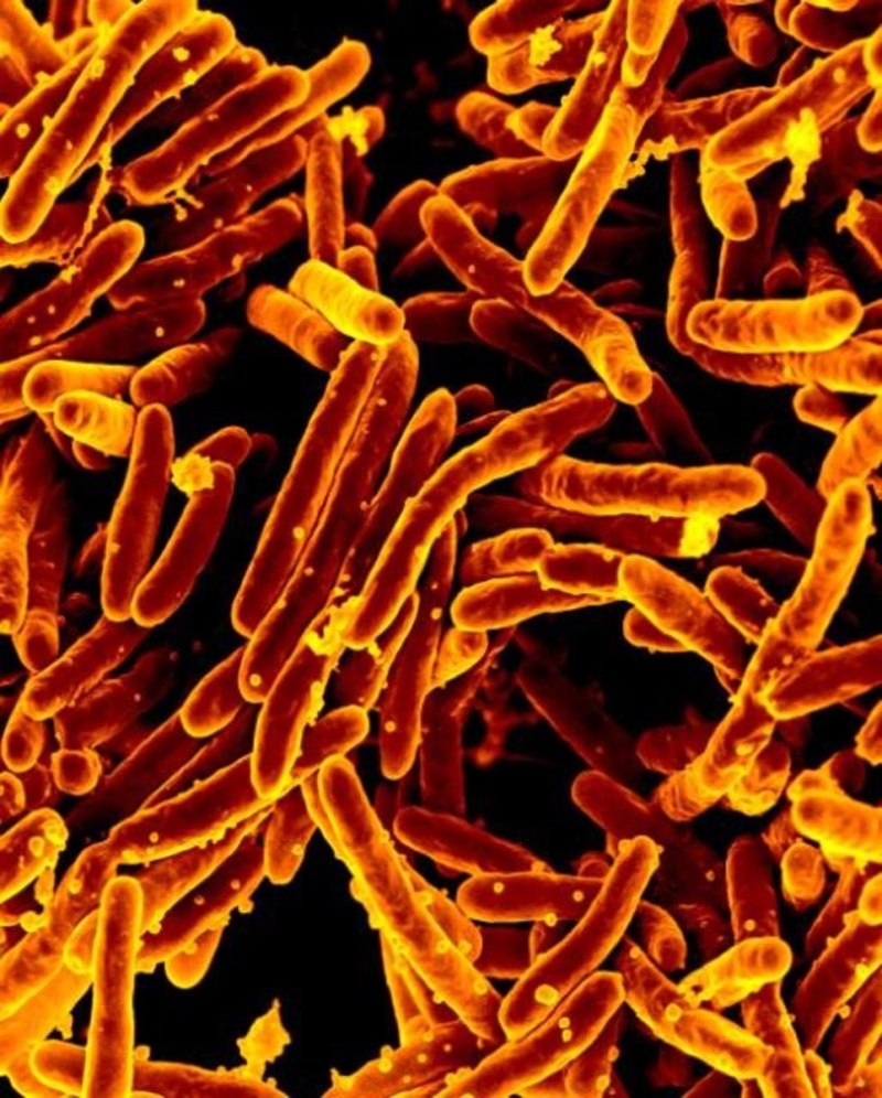Палочка Коха (Mycobacterium tuberculosis)