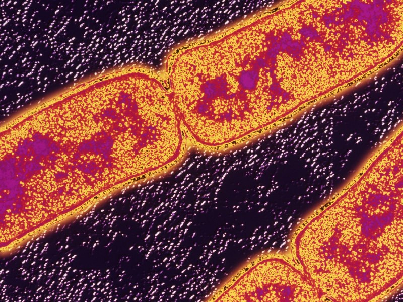 Палочка Коха (Mycobacterium tuberculosis)