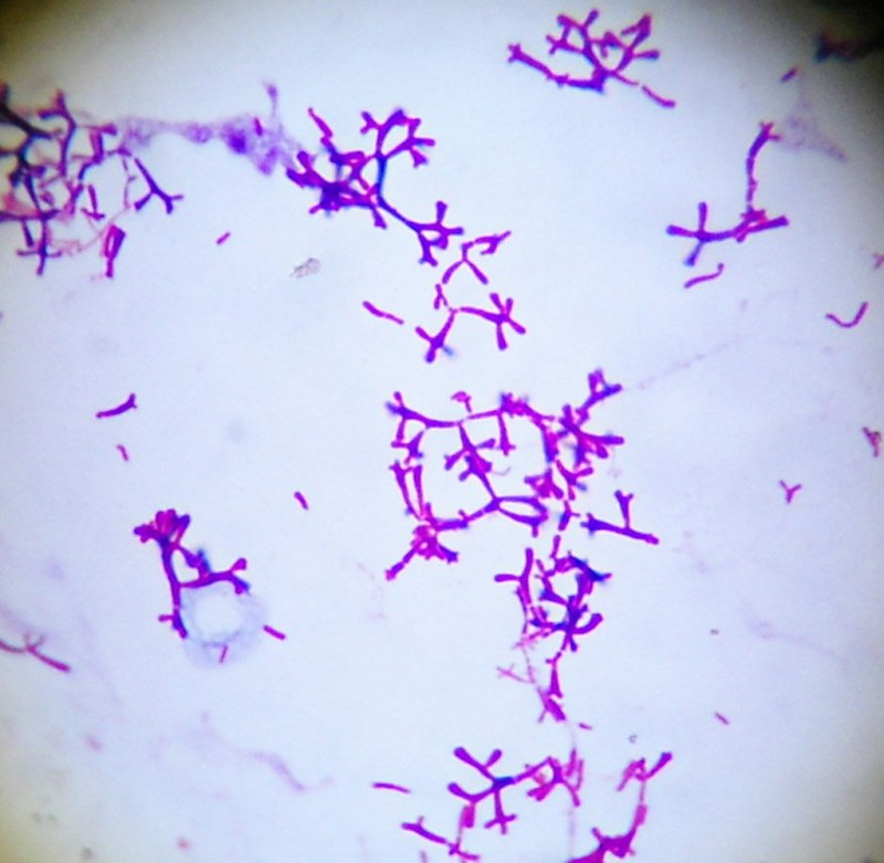 Bifidobacterium bifidum морфология