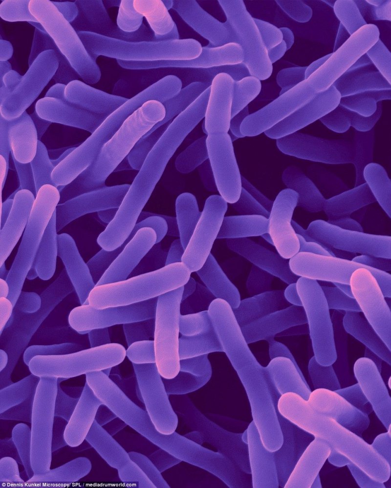 Bifidobacterium микроскоп