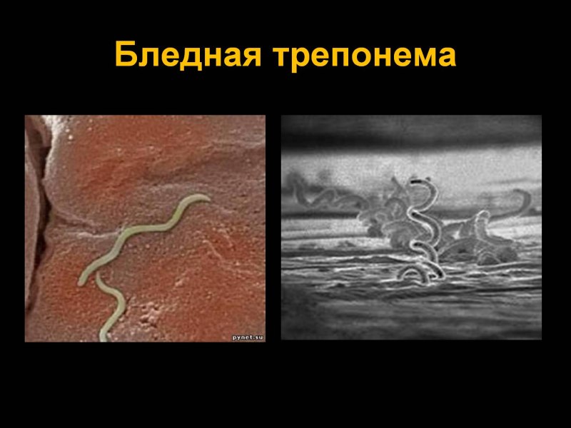 Сифилис бледная трепонема