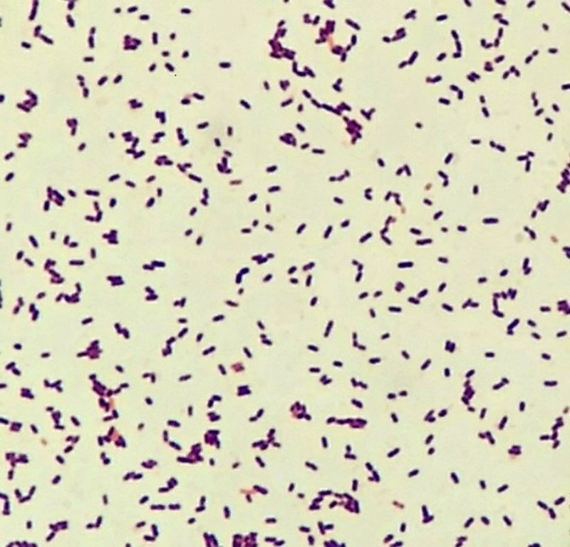 Listeria monocуtogenes (листерии)