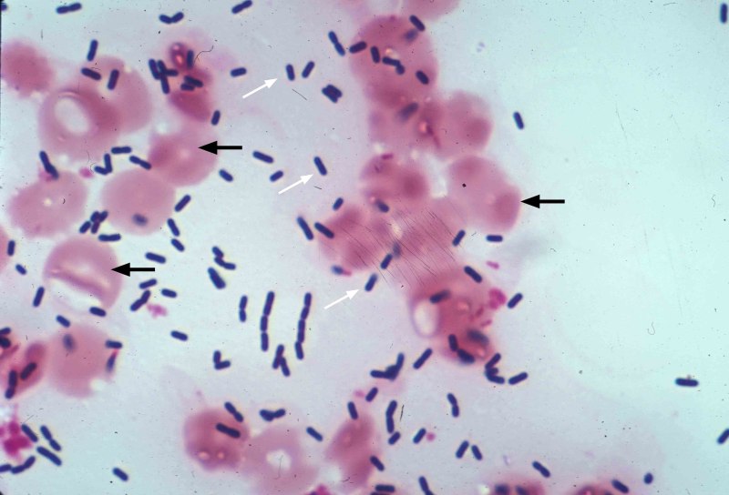 Listeria monocуtogenes (листерии)