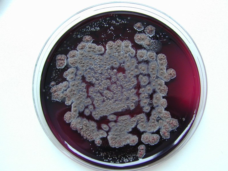 Бактерия Listeria monocytogenes