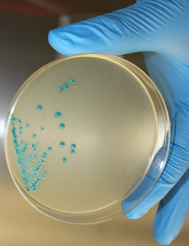 Listeria monocуtogenes (листерии)