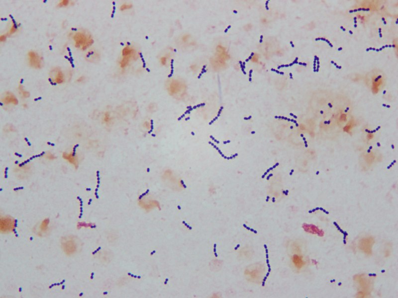 Listeria monocytogenes микроскопия