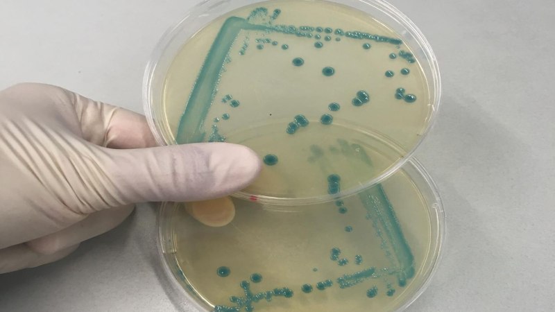 Бактерия Listeria monocytogenes