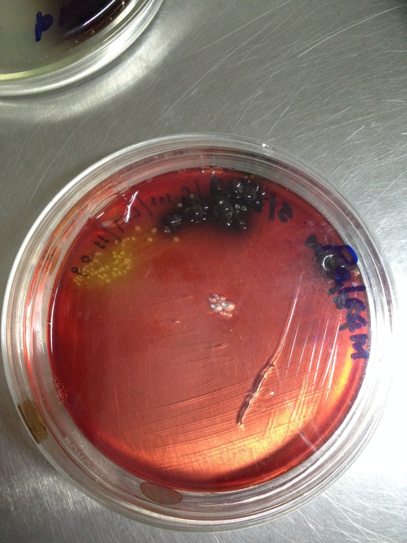 Listeria monocуtogenes (листерии)