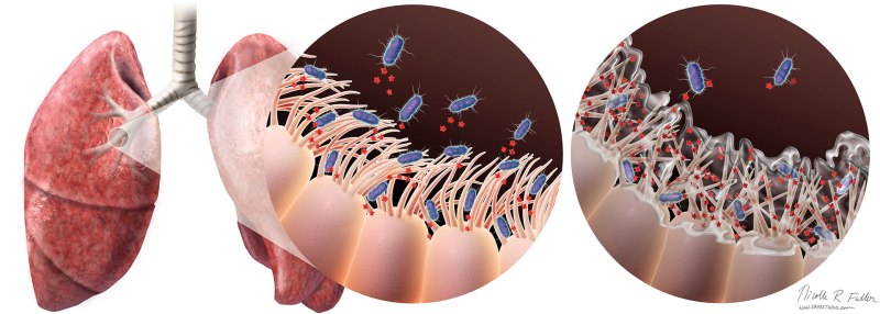 Возбудитель коклюша Bordetella pertussis