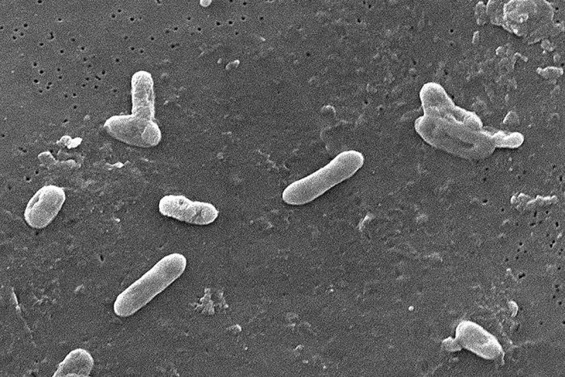 Коклюш Bordetella pertussis (бордетелла пертуссис)