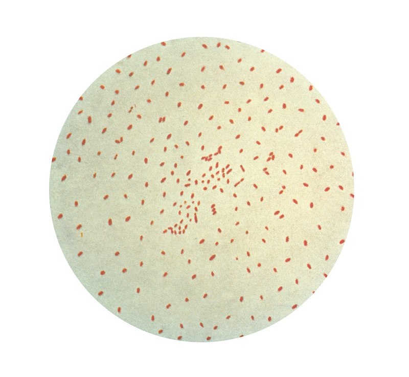 Bordetella пертуссис