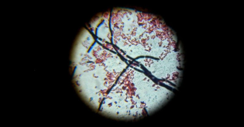 E.coli и Bacillus Cereus