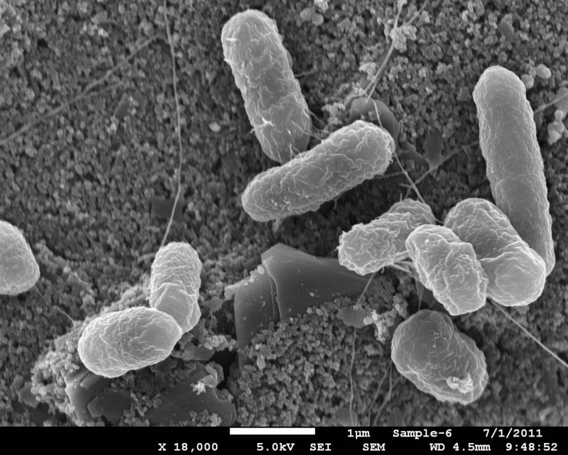 E-coli бактерия электронный микроскоп