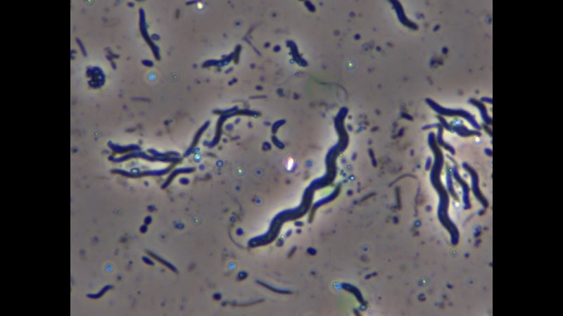 Spirillum winogradskyi